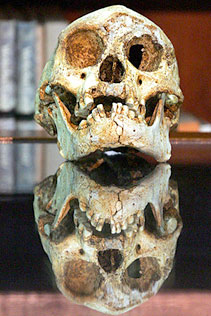 Hoobit - Homo floresiensis trisomique