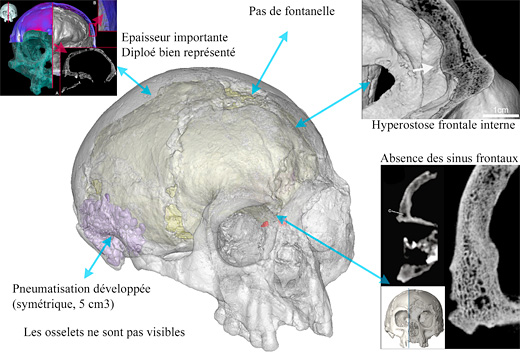 L'intérieur du crâne d'Homo floresiensis à l'étude... 