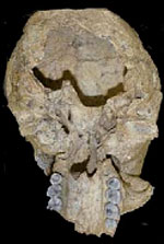 Crâne de Steinheim avec le trou occiptal elargi