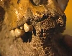 Australopithecus sediba - d&eacute;tail de la machoire 