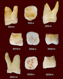 Dents d'Homo sapiens en Chine il y a 80 000 ans
