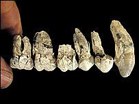 Dents d'Australopithecus anamensis
