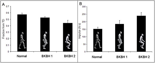 les differents type de bip&eacute;die 