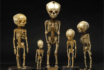 Squelettes de foetus de 3 mois à terme