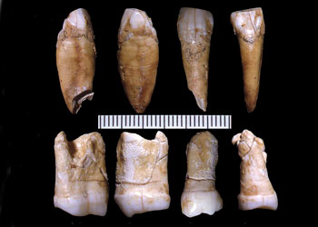 Les dents Aroeira appartenant aux individus  1 et 2