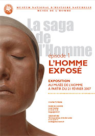 Homme exposé