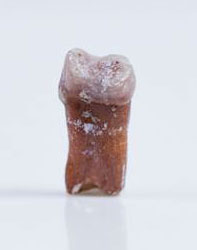 Dent Homo floresiensis