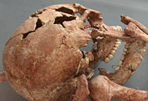 Crâne de Saint germain la Rivière