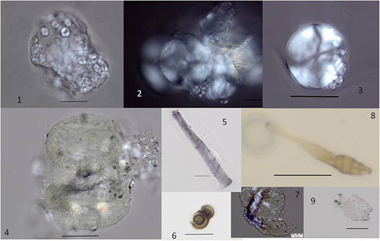 Microfossiles retrouvés dans le tartre dentaire d'un hominidé à Atapuerca