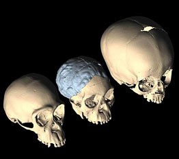 Comparaison cerveau australopitheque (enfant de Taung) avec les grands singes et l'homme moderne