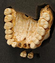 Dents de néandertal sur le site d'El Sidron