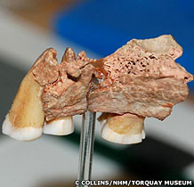 Les dents qui repoussent l'arrivée de sapiens en europe à moins 45 000 ans