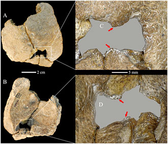 Foramen parietaux elargie - Xujiayao 11  - Une preuve de Consanguinité ?