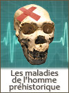 Maladie dans la préhistoire