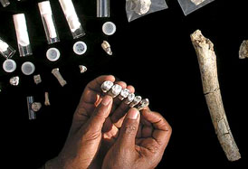 Restes fossiles d'Australopithècus anamensis : fémur et dents