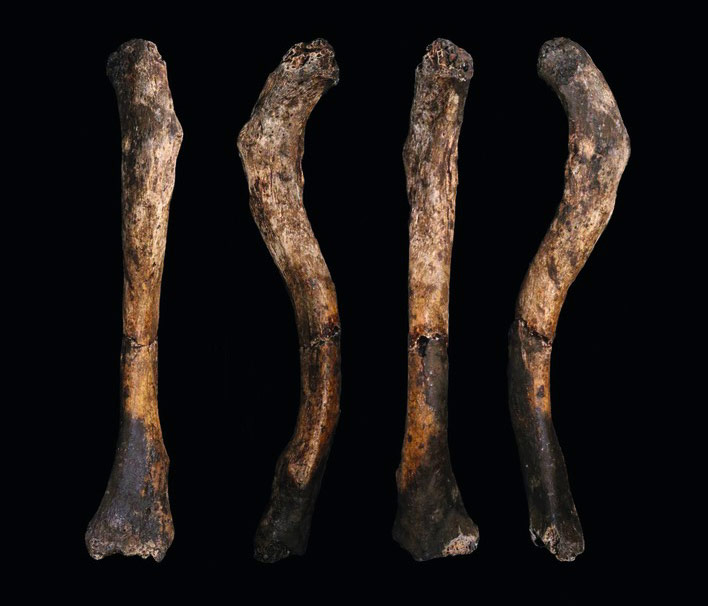 clavicule-droite-naledi