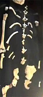 Australopithecus sediba - squelette