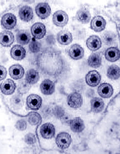 Le virus de l'herpes permet de retracer les migrations humaines depuis le paléolithique
