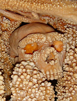 Crâne du néandertalien d'Altamura