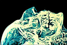 Radiographie du crâne de Ramses II