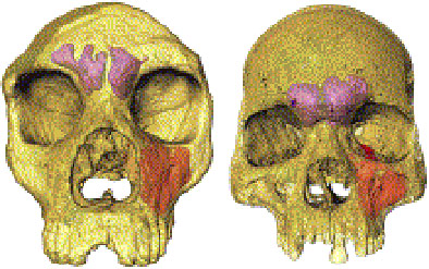Comparaison des sinus de Sapiens et de Néandertal