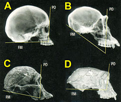 Comparaison radiographique des cränes de Toumaï, de l'Homo sapiens, du chimpanzé et d'un australopithèque