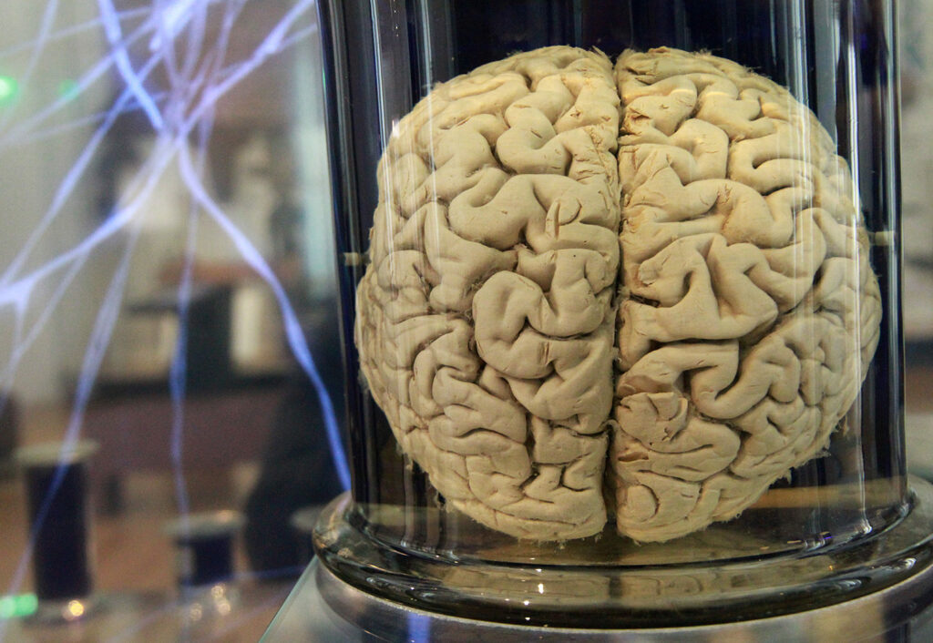 Cerveau humain formol