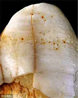 Traces dent de néandertal