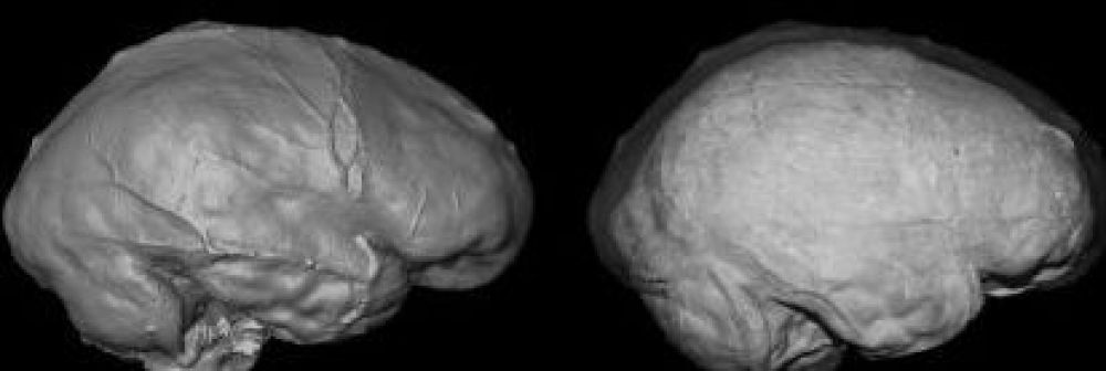 Homo sapiens avait un cerveau de taille plus importante il y a 30 000 ans !