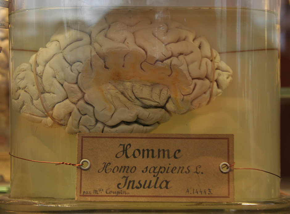 Cerveau homo sapiens