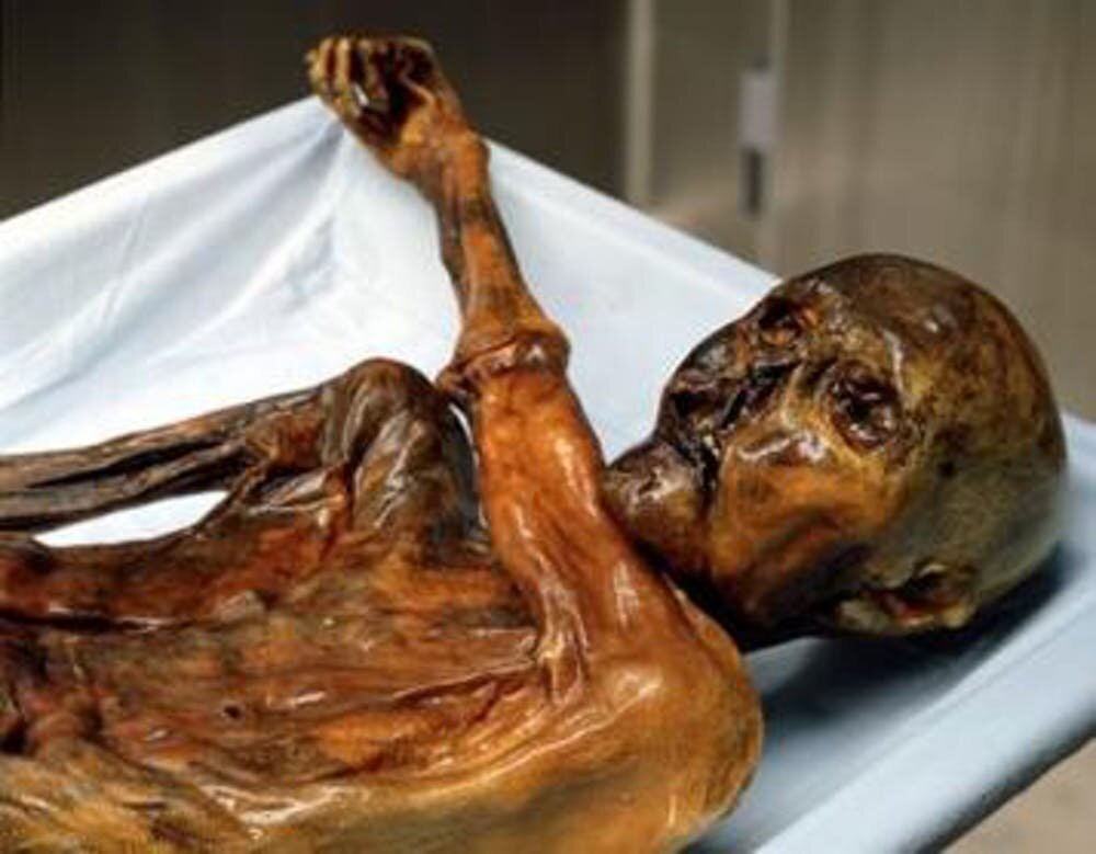 Otzi