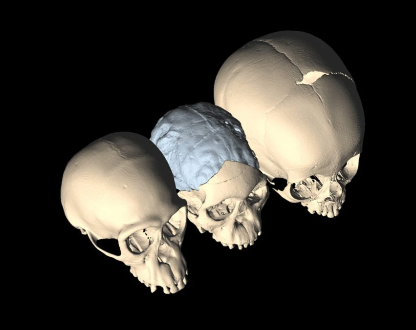 L’Australopithèque de Taung, cerveau et accouchement