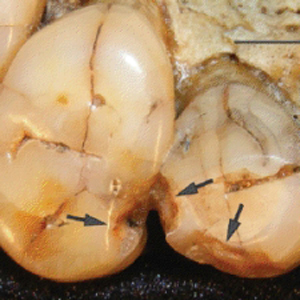 Les dents abîmées peuvent révéler l’alimentation d’un ancien hominidé.