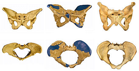 Homo erectus avait-il la grosse tête ?