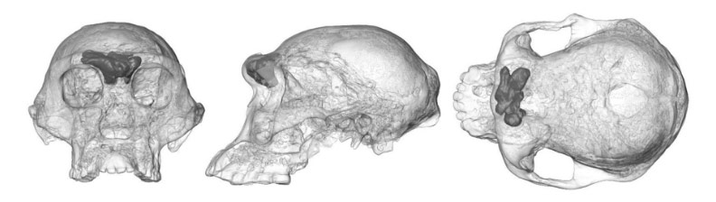 Les sinus pour mieux comprendre l'évolution humaine - Hominides