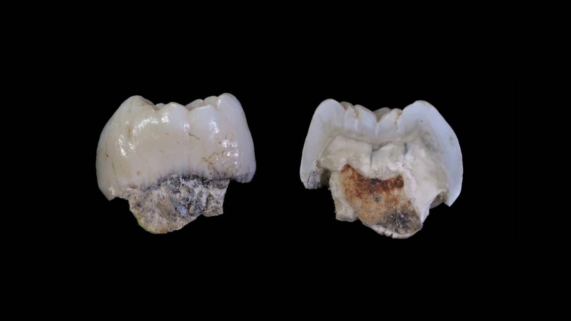 Des données génétiques extraites des dents d’un hominidé de 2 millions d’années.