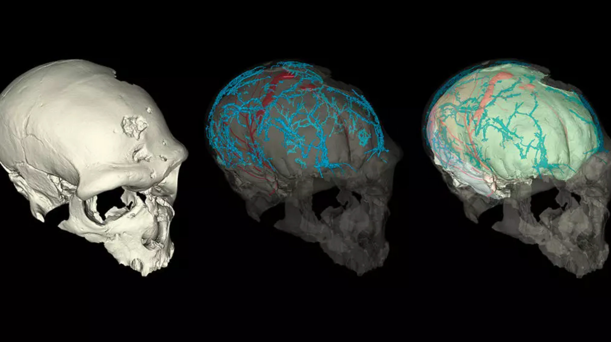 PaléoBrain